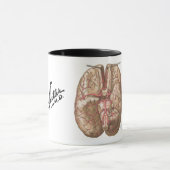 Netter Basal View of Brain  - Mug Mok (Midden)