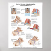 Netter Chart: Central Venous Catheterization Poster (Voorkant)