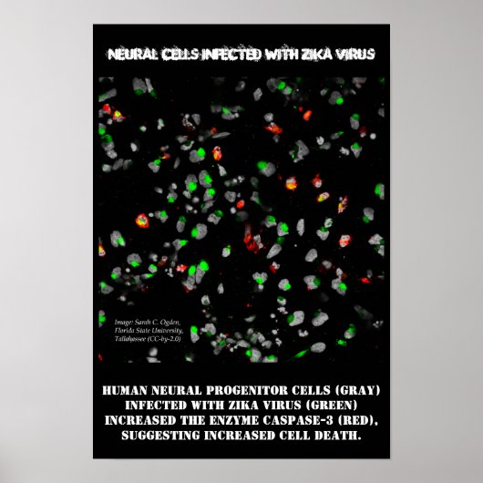 Neurale cellen Geïnfecteerd met Zika-Poster door R Poster (Voorkant)