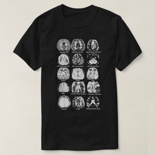 Neurologie Brain Dvhh Pml T-shirt (Design voorkant)