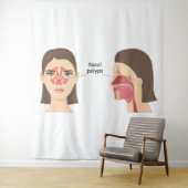 Neuspoliepen Wandkleed (In situ)