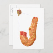 Nierbeschadiging en het filtratiemembraan briefkaart (Voorkant / Achterkant)