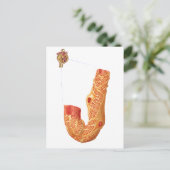 Nierbeschadiging en het filtratiemembraan briefkaart (Staand voorkant)