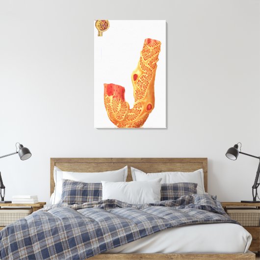 Nierbeschadiging en het filtratiemembraan canvas afdruk (Insitu (Slaapkamer))