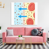 Nierdialyse Canvas Afdruk (Insitu (Woonkamer))