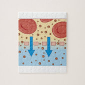 Nierdialyse Legpuzzel (Verticaal)