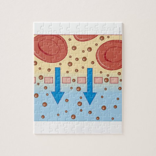 Nierdialyse Legpuzzel (Verticaal)