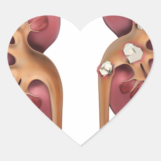 nieren hart sticker (Voorkant)