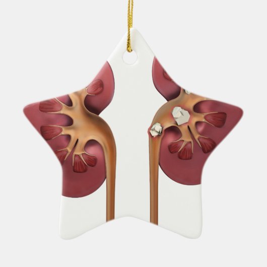 nieren keramisch ornament (Voorkant)