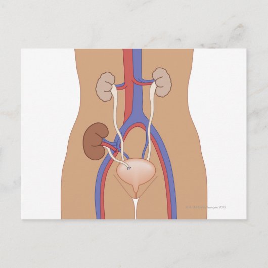Niertransplantatie Briefkaart (Voorkant)