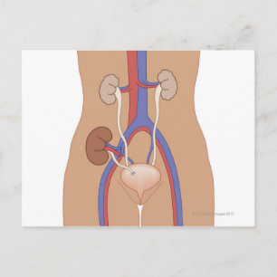 Niertransplantatie Briefkaart