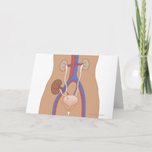 Niertransplantatie Kaart