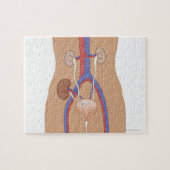 Niertransplantatie Legpuzzel (Horizontaal)