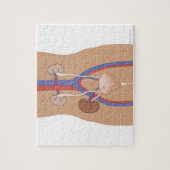 Niertransplantatie Legpuzzel (Verticaal)