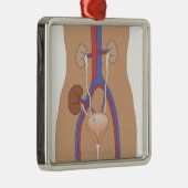 Niertransplantatie Metalen Ornament (Rechts)