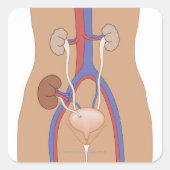 Niertransplantatie Vierkante Sticker (Voorkant)