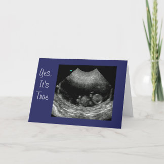 Nieuw Baby Anouncement Aankondiging