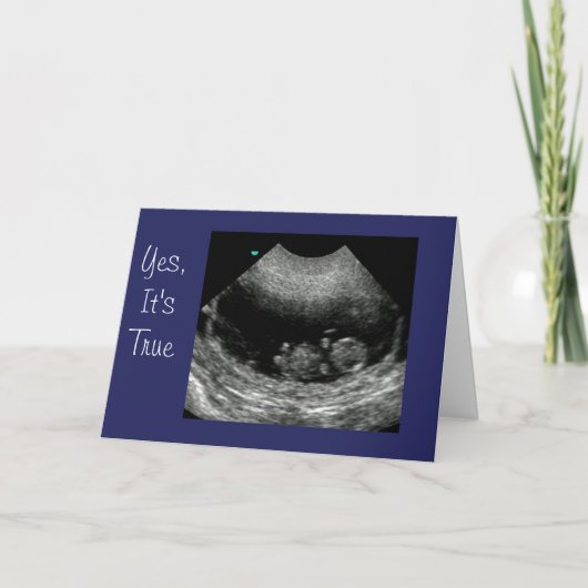 Nieuw Baby Anouncement Aankondiging (Voorkant)