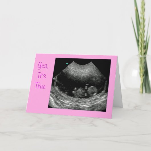 Nieuw babyRoze Aankondiging (Voorkant)
