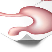 Nissen Fundoplicatimaag Poster voor chirurgie (Hoek)