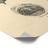 Noot Throat Anatomy 1880 Afdruk Poster (Hoek)