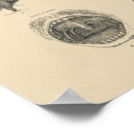  Noot Throat Anatomy 1880 Afdruk Poster (Hoek)