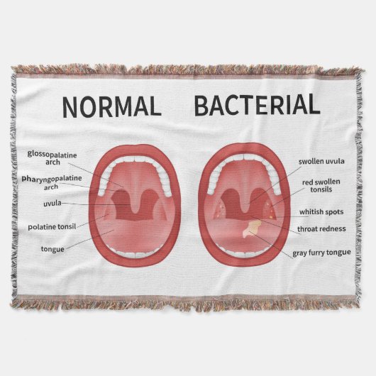 Normaal bacterieel deken (Voorkant)