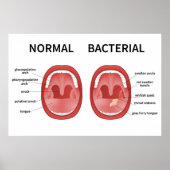Normaal bacterieel poster (Voorkant)