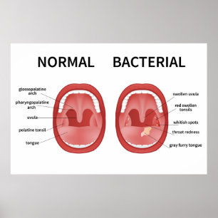 Normaal bacterieel poster