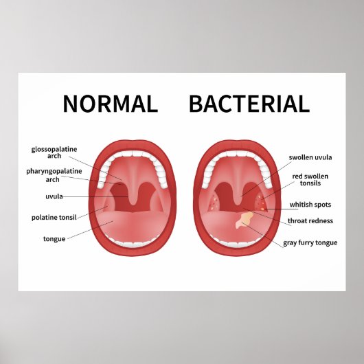Normaal bacterieel poster (Voorkant)