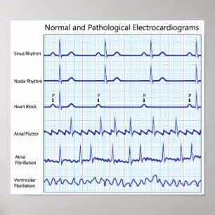 Normaal en pathologisch Poster