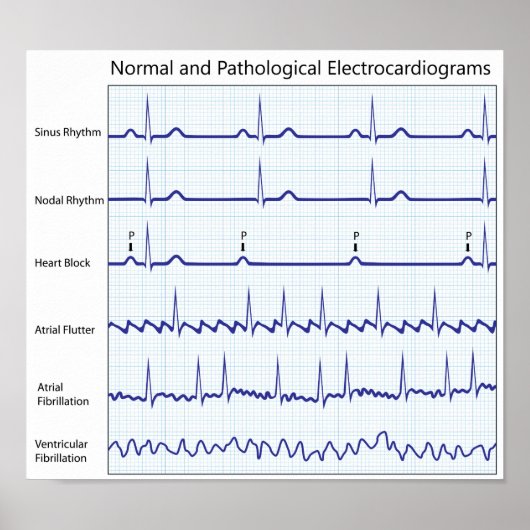 Normaal en pathologisch Poster (Voorkant)