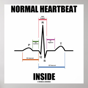 Normale hartslag in ECG ECG-elektrocardiogram Poster