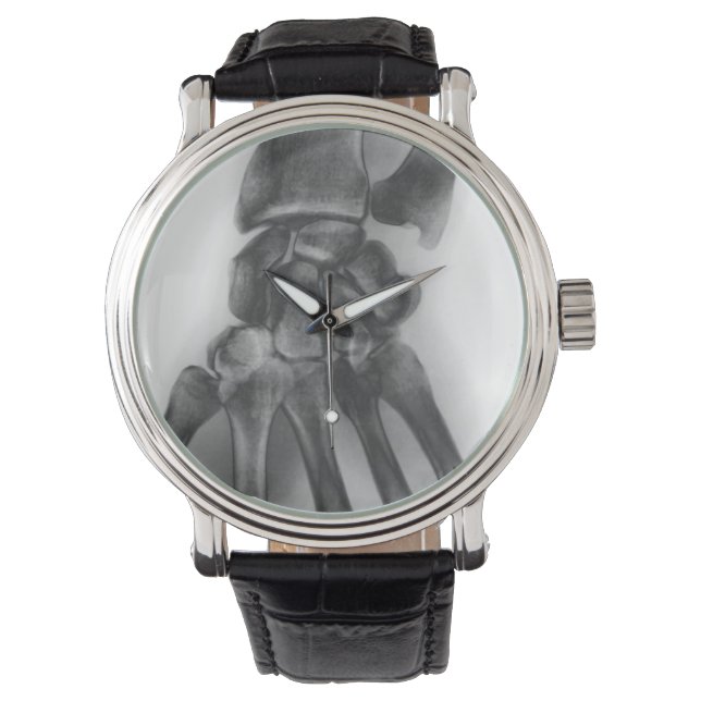 Normale pols, röntgenstraal horloge (Voorkant)