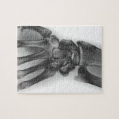 Normale pols, röntgenstraal legpuzzel (Horizontaal)