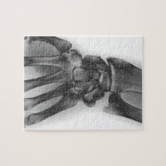 Normale pols, röntgenstraal legpuzzel (Horizontaal)