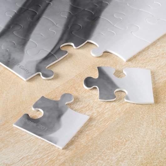 Normale pols, röntgenstraal legpuzzel (Zijkant)