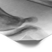 Normale pols, röntgenstraal poster (Hoek)