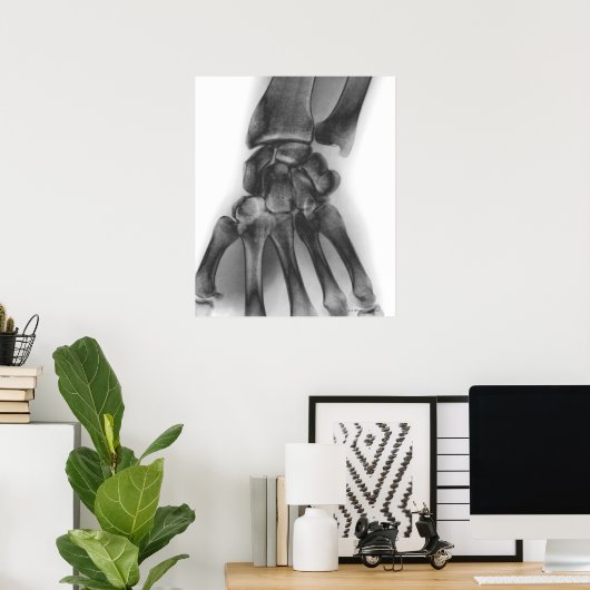 Normale pols, röntgenstraal poster (Thuiskantoor)