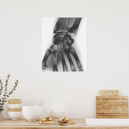 Normale pols, röntgenstraal poster (Keuken)