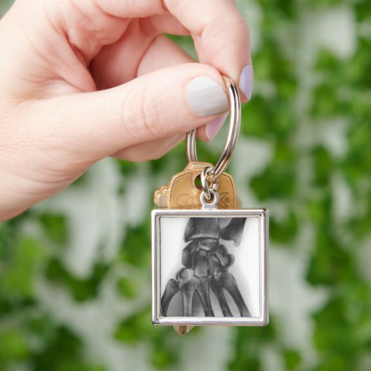 Normale pols, röntgenstraal sleutelhanger (Hand)