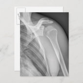 Normale schouder. Röntgenfoto van de gezonde linke Briefkaart (Voorkant / Achterkant)