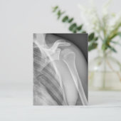 Normale schouder. Röntgenfoto van de gezonde linke Briefkaart (Staand voorkant)