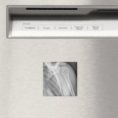 Normale schouder. Röntgenfoto van de gezonde linke Magneet (Insitu (Vaatwasser))