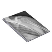 Normale schouder. Röntgenfoto van de gezonde linke Notitieboek (Rechterzijde)