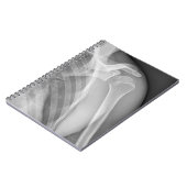 Normale schouder. Röntgenfoto van de gezonde linke Notitieboek (Linkerzijde)