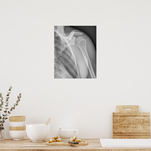 Normale schouder. Röntgenfoto van de gezonde linke Poster (Keuken)