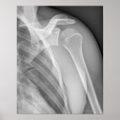 Normale schouder. Röntgenfoto van de gezonde linke Poster (Voorkant)