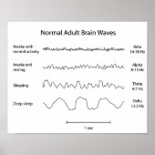 Normale volwassen hersengolven, bijvoorbeeld Poste Poster (Voorkant)
