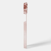 Ob/Gyn MidWITSERSE BRODBAARHEID Cervix Ovaria iPhone Hoesje (Rechterkant)